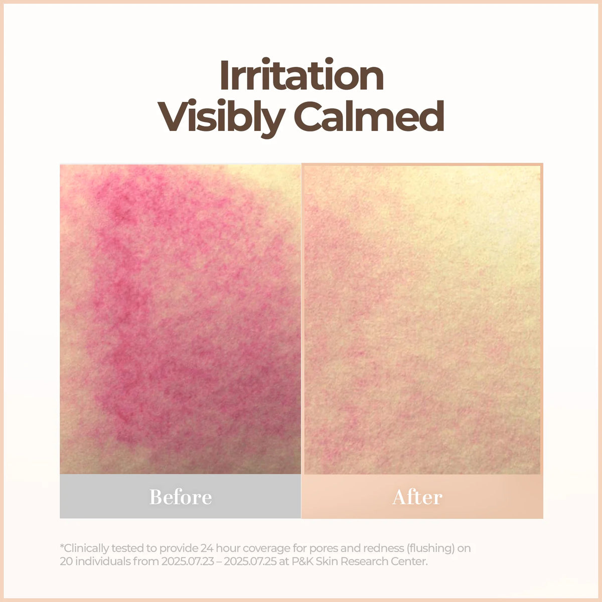 Korean Blemish Balm